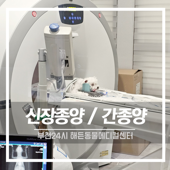 [종양외과] 신장종양, 간 종양 CT촬영 및 수술 후기