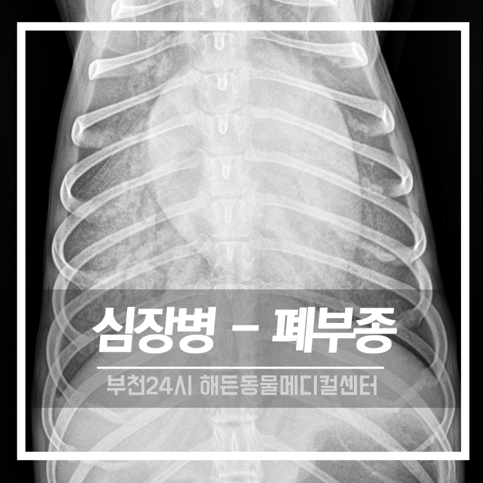 [내과] 심장병 - 폐부종 치료후기