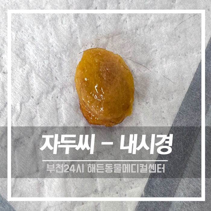 [내과] 내시경으로 자두씨 제거